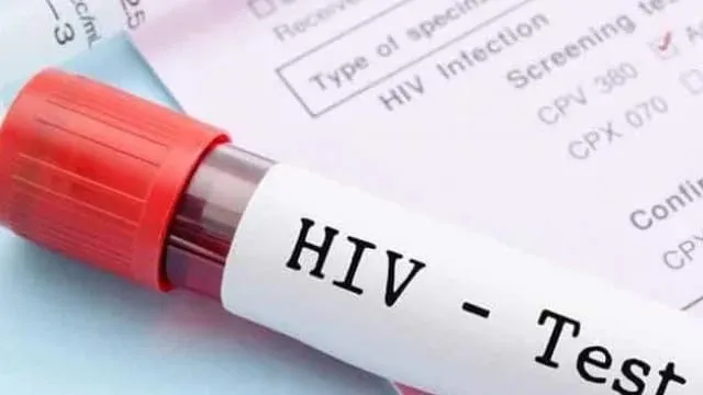 AIDS