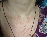 Tawdu News:नकाबपोश बदमाशों ने घर में घुसकर की लूटपाट, डेढ़ तोला सोने की हसली व लाखों का सामान ले गए, महिला घायल