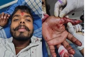 Palwal/Hodal News: प्रतिबंधित चाइनीज मांझे की चपेट में आने से मोटरसाइकिल सवार हुआ घायल