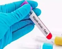 कोरोना के बाद भारत में निपाह वायरस का बढ़ता खतरा, WHO ने किया अलर्ट