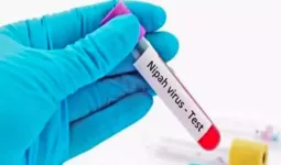 कोरोना के बाद भारत में निपाह वायरस का बढ़ता खतरा, WHO ने किया अलर्ट